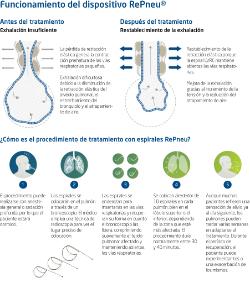 Infografia Dispositivo PneumRx
