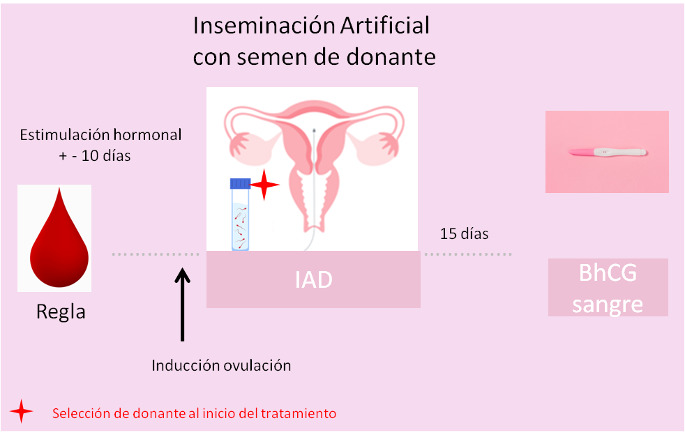 Inseminación artificial con semen donante