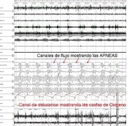 prueba_complemantaria_ums