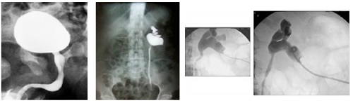 radiología