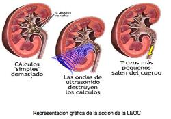 LEOC