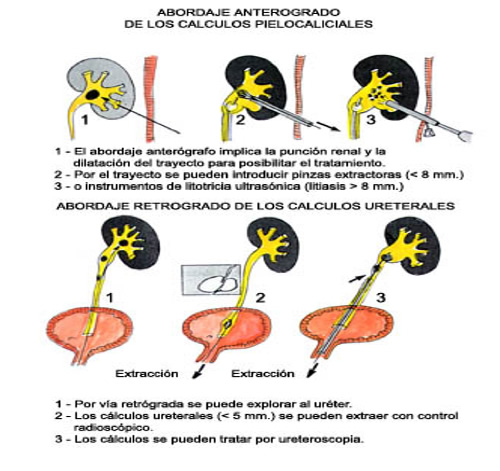 Abordaje