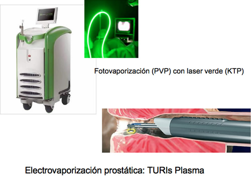 Vaporizacion