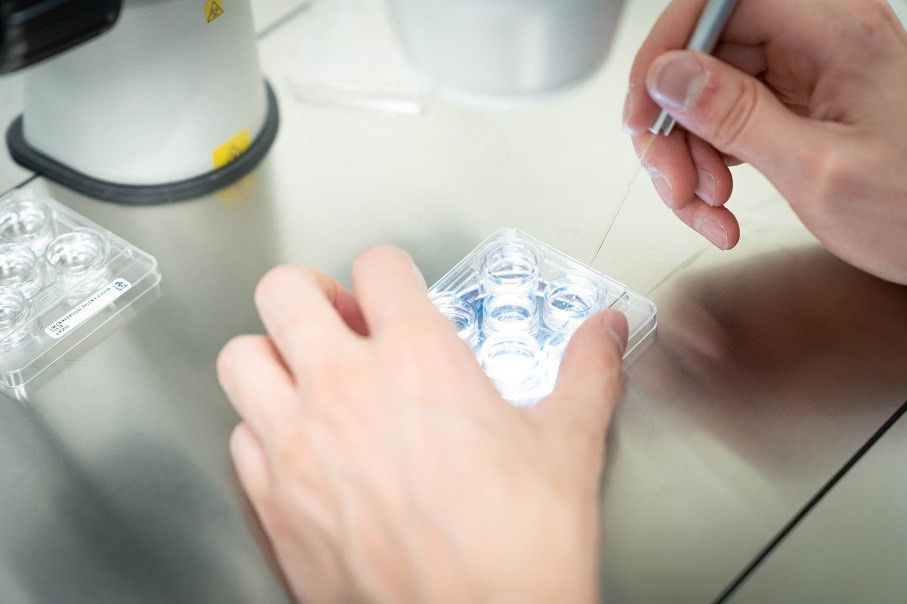 Ovocito Fecundación in Vitro