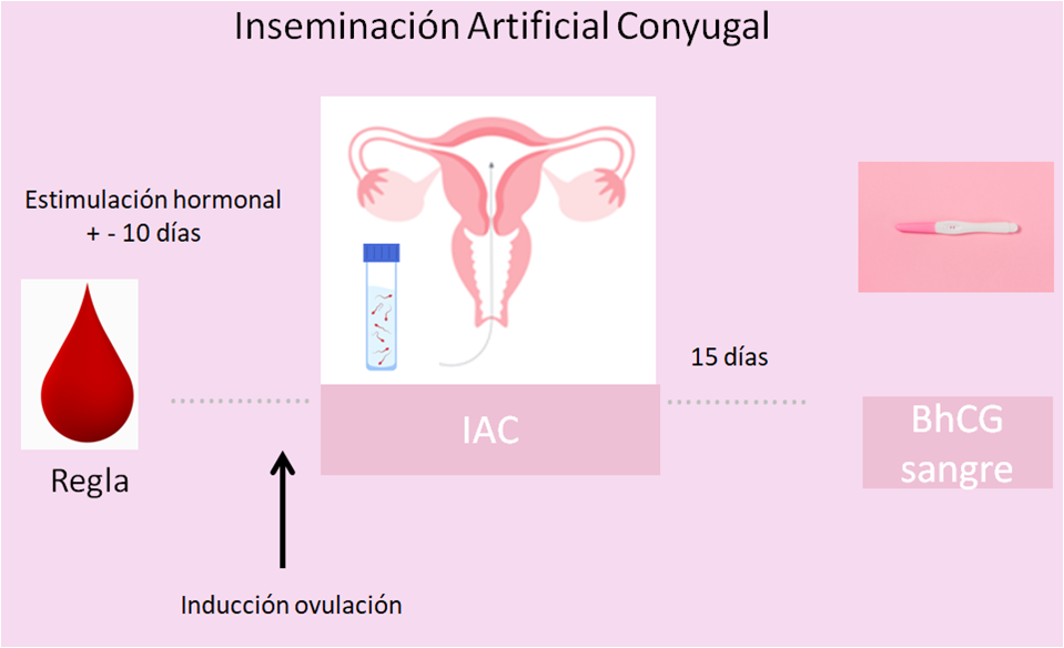 Inseminación Artificial Conyugal
