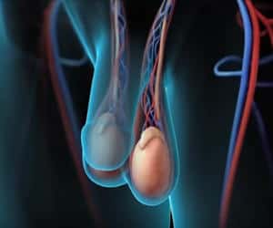 varicocele-hombres