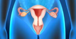 Embolización de miomas uterinos y síndrome de congestión pélvica
