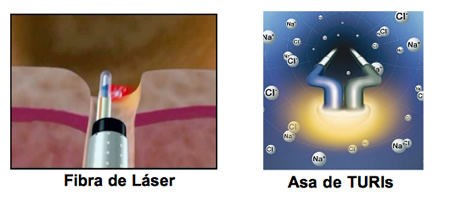 Láser