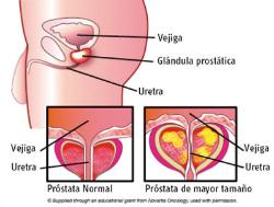 Qué es la próstata