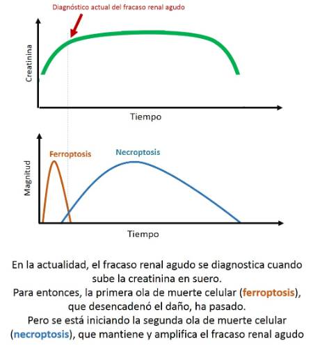 Diagnóstico del fracaso renal agudo