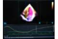 Heart Model dinámico