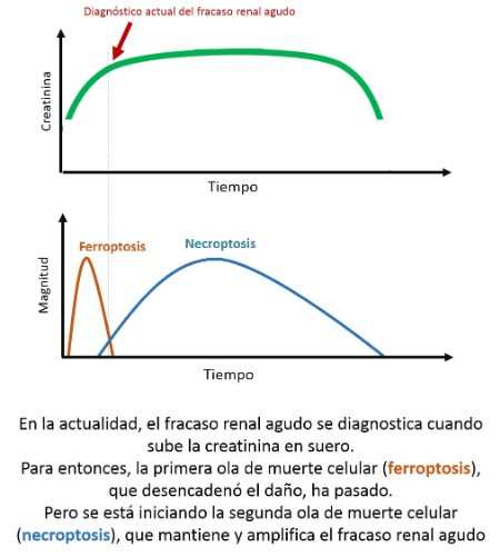 Diagnóstico del fracaso renal agudo
