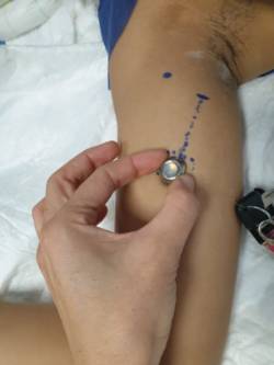 FJD_ACCESO_VASCULAR_EXPERTO_2