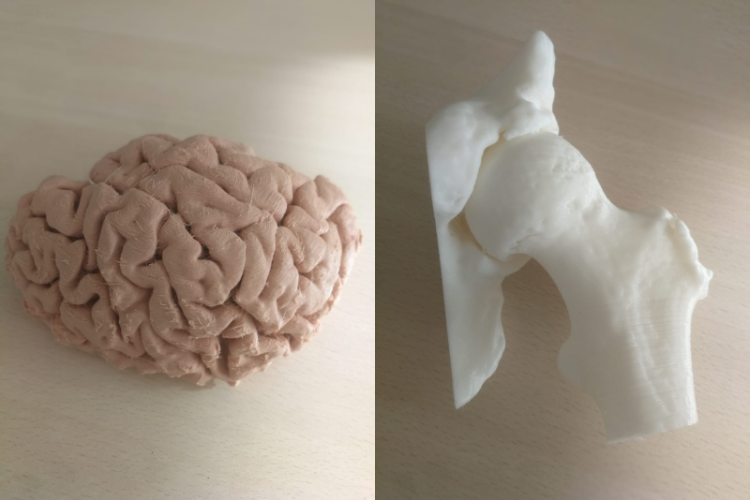 cerebro cadera