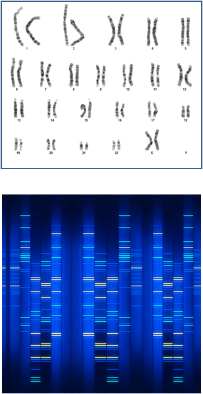 Genetic and rare diseases