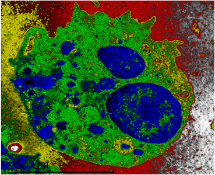 Infectious diseases And_Research Area