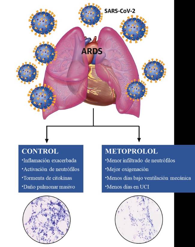 2021 08 30 Metoprolol mejora la función pulmonar