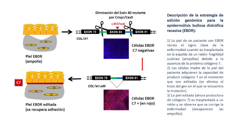 2019 04 08 Edición genómica epidermólisis quironsalud